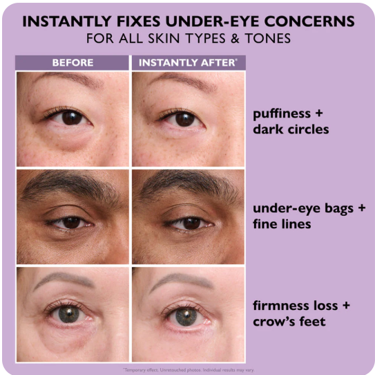 ⭐ Instant Eye Lift Magic Cream E-Book