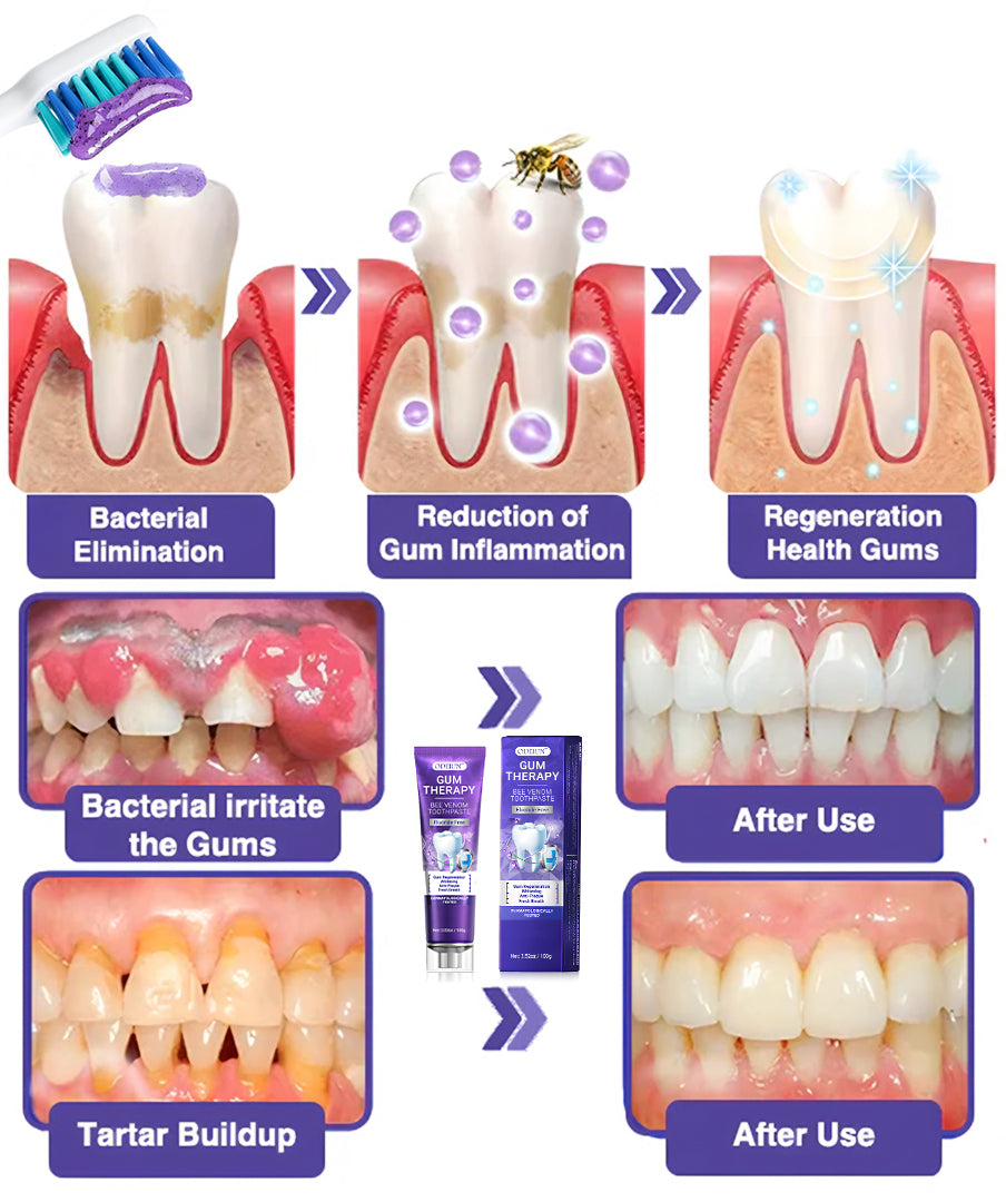 Oralhoe™Bee Venom Toothpaste